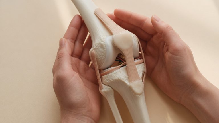 Cómo aliviar el dolor articular naturalmente